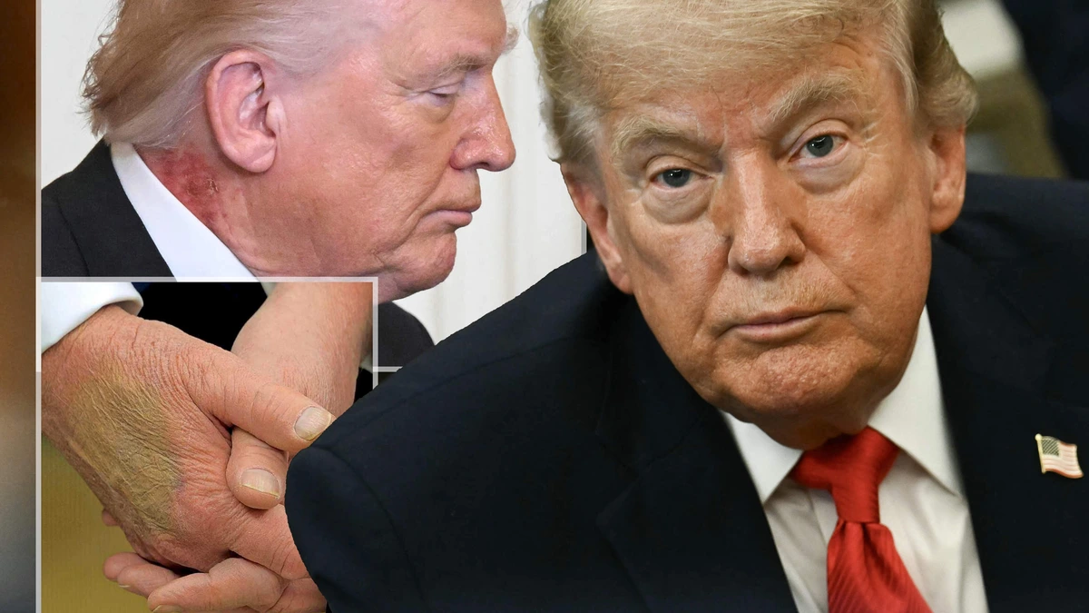 Trump met 80 jaar ’kerngezond’, maar twijfels over halen einde termijn: volop speculatie over medische issues