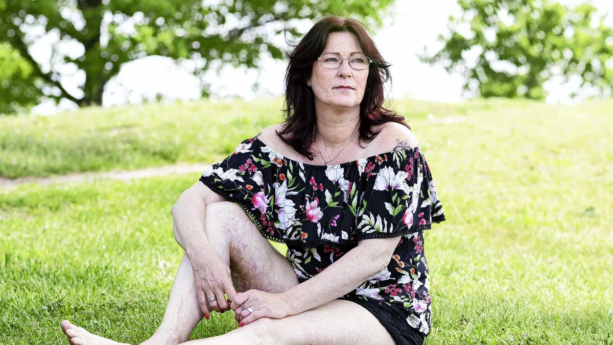 Conny (54) kreeg frituurolie over zich heen: ’Een vijfde van mijn lichaam was verbrand’