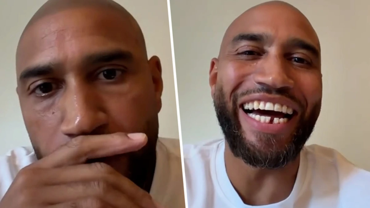 Edson da Graça onthult gebit na ingrijpende ingreep: ‘Wees gewoon eerlijk in de comments’