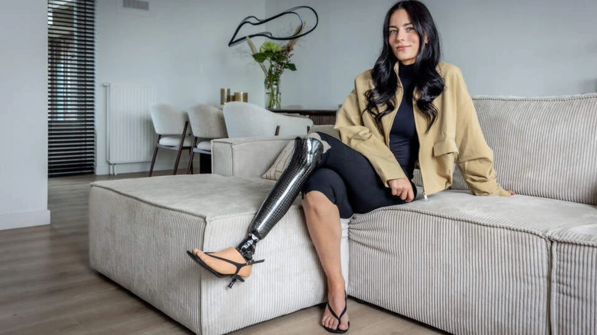 Manon (27) draagt haar beenprothese met trots: ’Als een ander me ziet en het daarna ook durft, daar doe ik het voor’