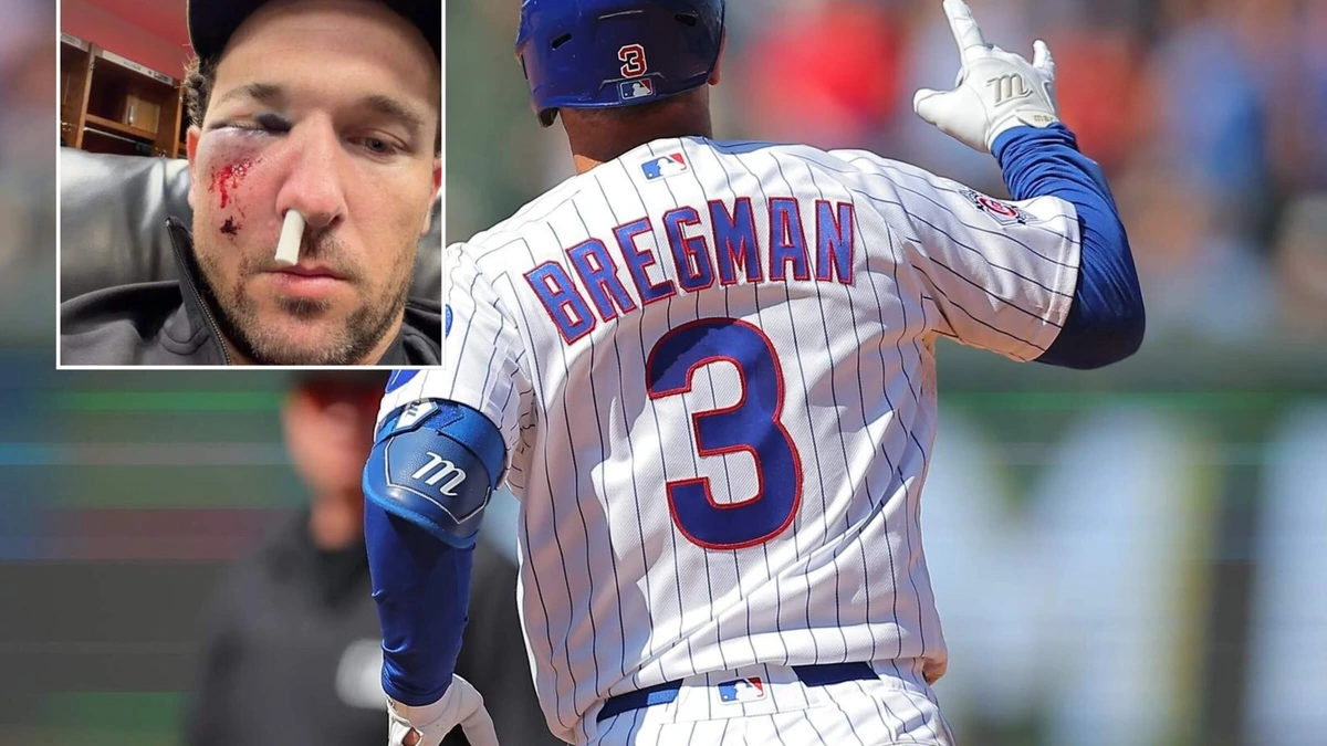 Honkballer Alex Bregman letterlijk ziekenhuis ingeslagen na foutslag van 154 kilometer per uur
