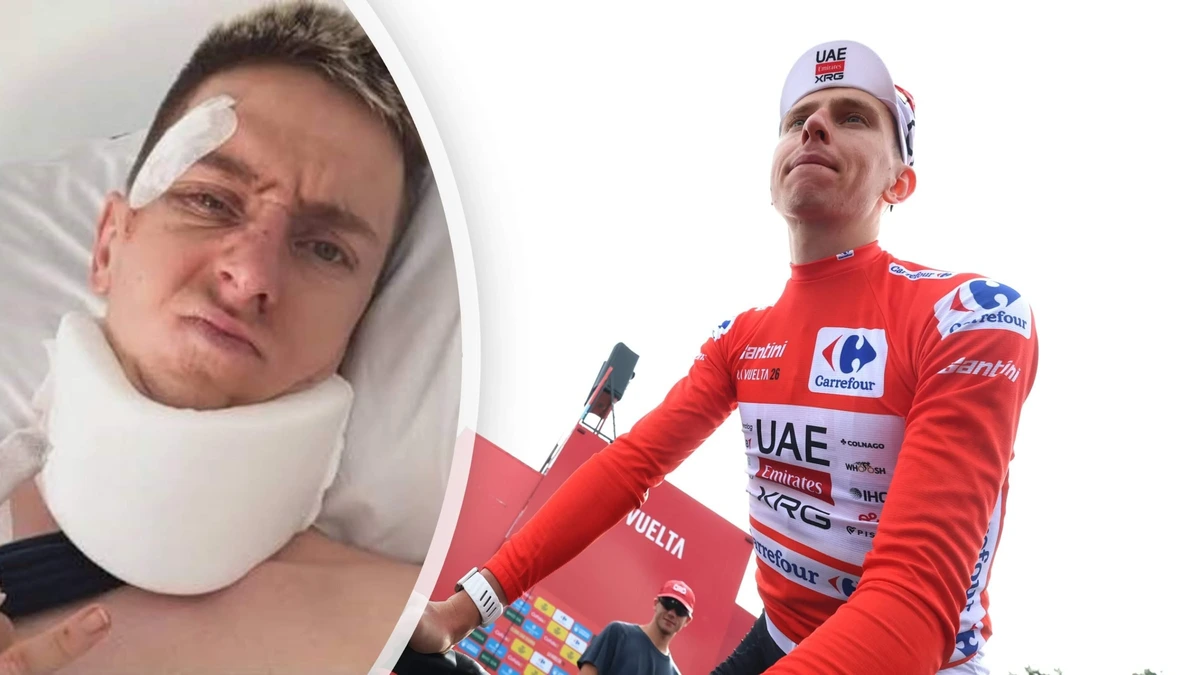 Tadej Pogacar brak niet één maar drie wervels bij val in Vuelta