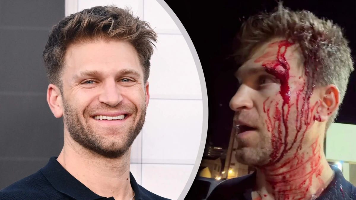 ’Pretty little liars’-ster Keegan Allen (37) slachtoffer brute overval: ’Twee gasten sloegen me op mijn hoofd en richtten een pistool op me’