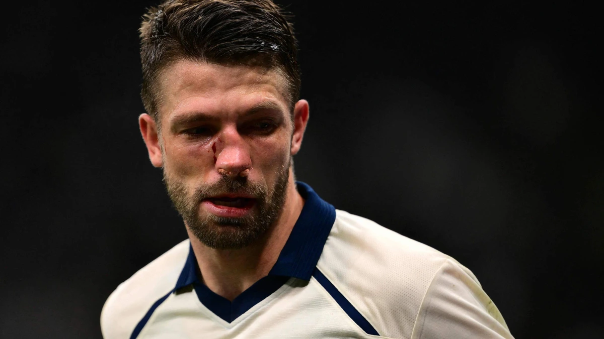 Zege Club Brugge in San Siro extra heroïsch: ’krijger’ Brandon Mechele speelde waarschijnlijk door na neusbreuk